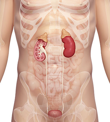kidney body
